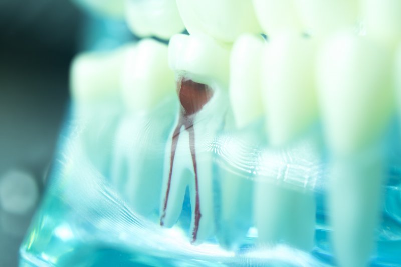 Digital illustration of a root canal